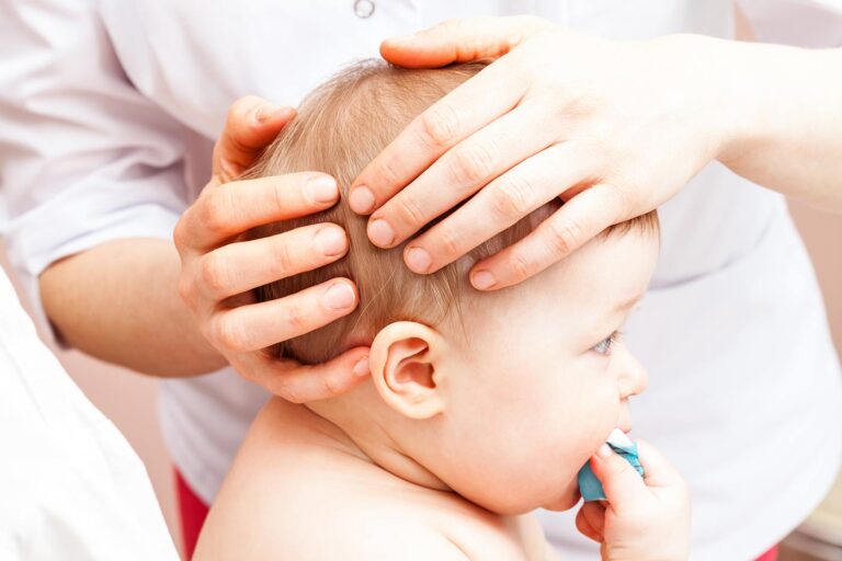 What to Do If You Notice Pimples on Your Baby’s Head